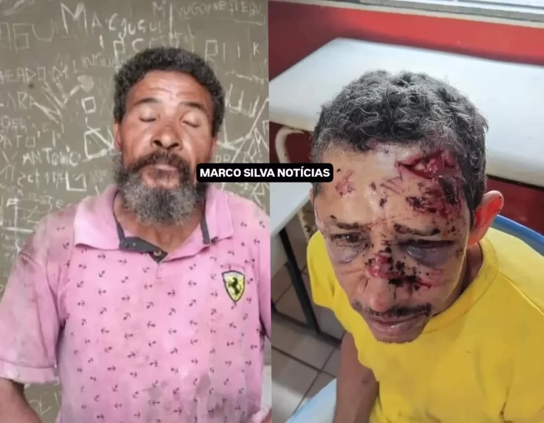 A vítima foi atacada a tijoladas - Foto: Marco Silva Notícias